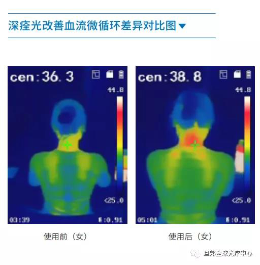 頸椎亞健康有多要命？很危險！(圖7)