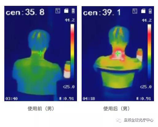 頸椎亞健康有多要命？很危險！(圖8)