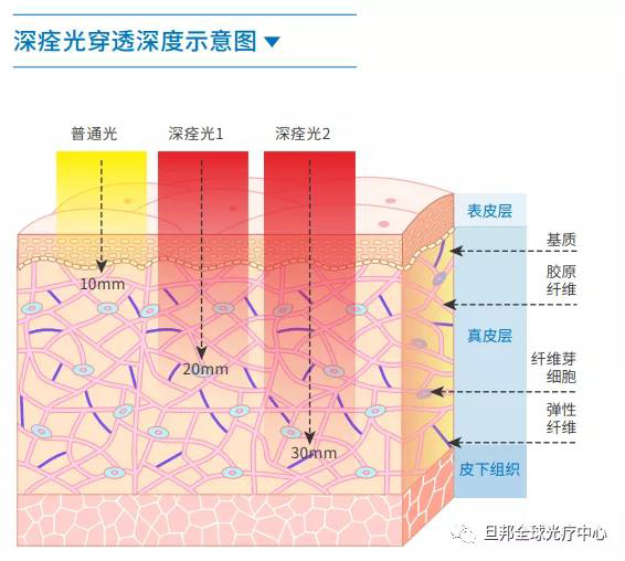 震驚中外的“深痊光”，黑科技臍光寶光療儀發(fā)布！(圖5)